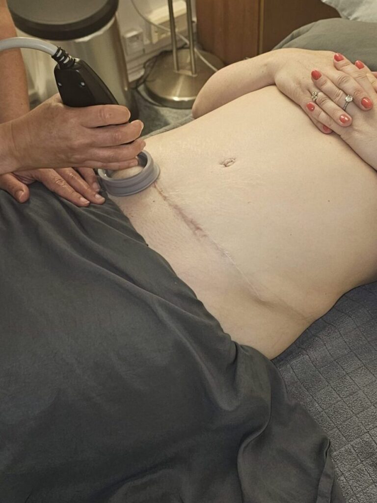 The Surprising Truth About Scar Therapy: Why Scars May Affect More Than Your Skin 2 20260608 120948 edited 1